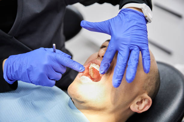 Best Cracked Tooth Emergency Dentist  in Parkville, MD