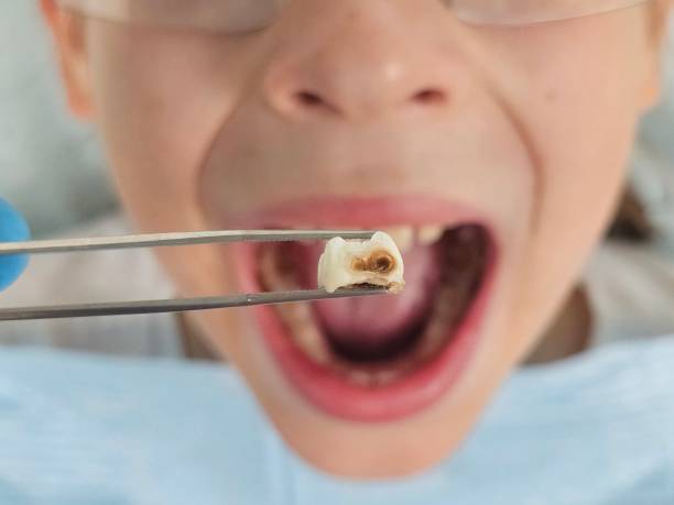 Best Teeth Whitening  in Parkville, MD